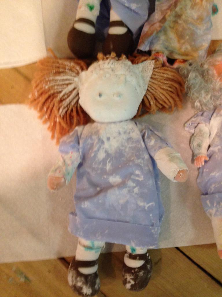 KristinaSmith75's tweet photo. Not sure what happened to this patient Physician assistants @ VBS have "cast" her and fixed it I'm sure #KidsOnCall http://t.co/gwYYNgM9Dn