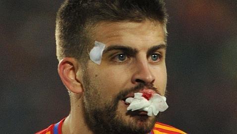 UnAutenticoCule's tweet photo. Ese jugador que haSANGRADO la camiseta de España y defendido como nadie,hoy le pitan por hablar.Libertad de expresión http://t.co/SuCd9AK0nm
