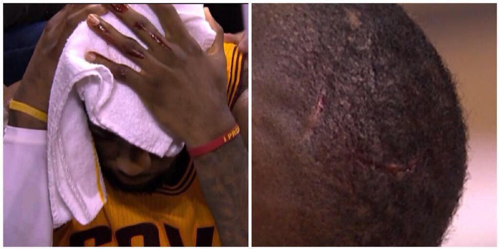 ADePallo's tweet photo. "Nobody makes me bleed my own blood" - @KingJames http://t.co/OyhwKXO825