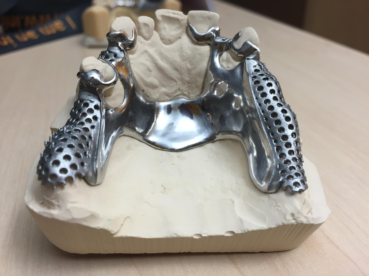 infiniDent's tweet photo. Handling just like cast partials, higher degree of geometric freedom and very little manual reworking. #inDividualPF http://t.co/9TfvJKwfVl
