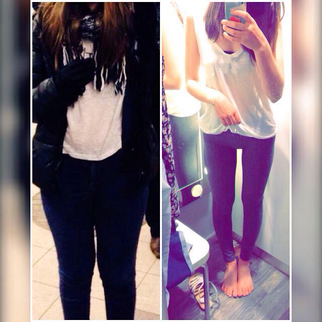 befitxndhealthy's tweet image. Elle a tellement bien réussi 💪 @_objectifthin #beproud