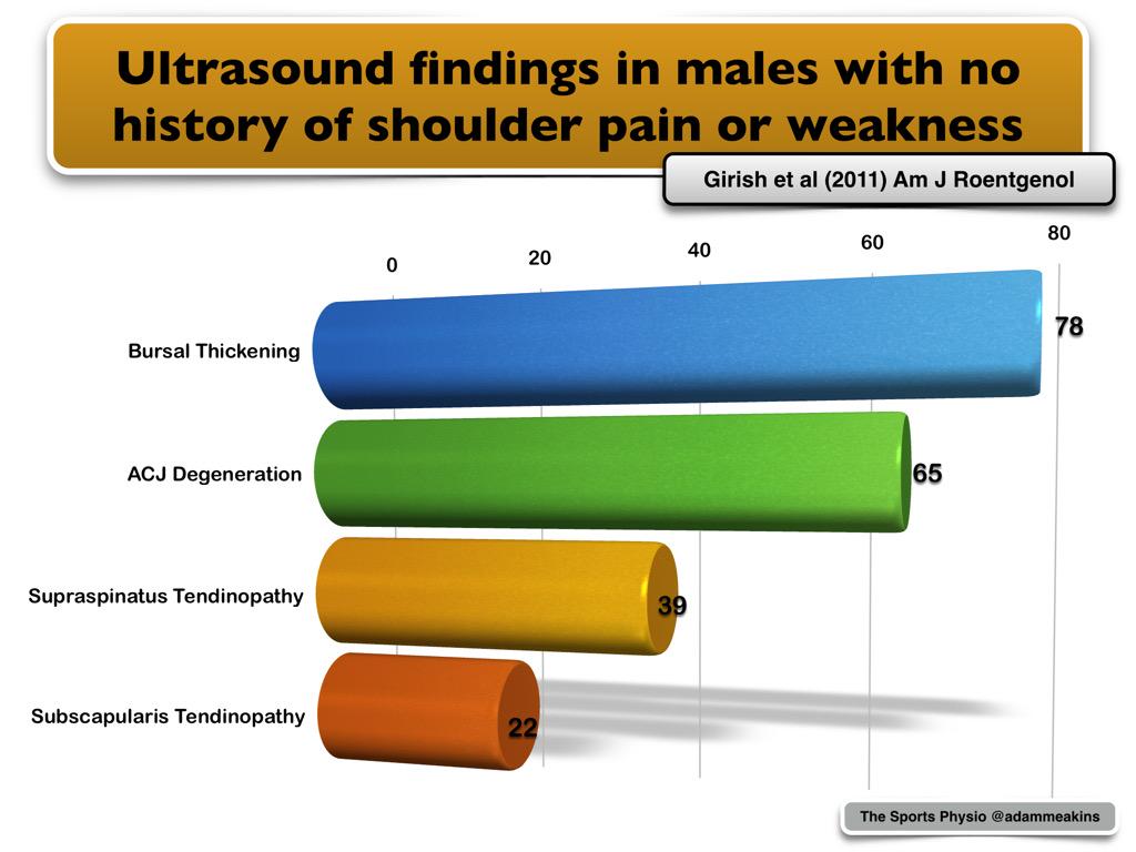 AdamMeakins's tweet image. Asymptomatic 'abnormalities' found in 96% of US shoulder scans ncbi.nlm.nih.gov/pubmed/?term=G… #TheyreNotAbnormalitiesThen
