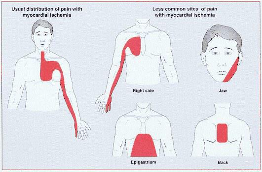 Боли в животе. Ноющая боль в верхней. Боль в верхней части живота. Болит верхняя часть грудной клетки слева. Болит спина.
