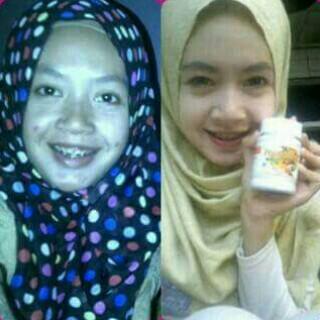 simplishop's tweet photo. Mau putih kaya artis2.?? Putih.? Mulus.? Cantik.?? Ini solusinya sms ke 085927474383 ato pin 54A329E8 buruaann :D http://t.co/wFjQ7Jkg8y