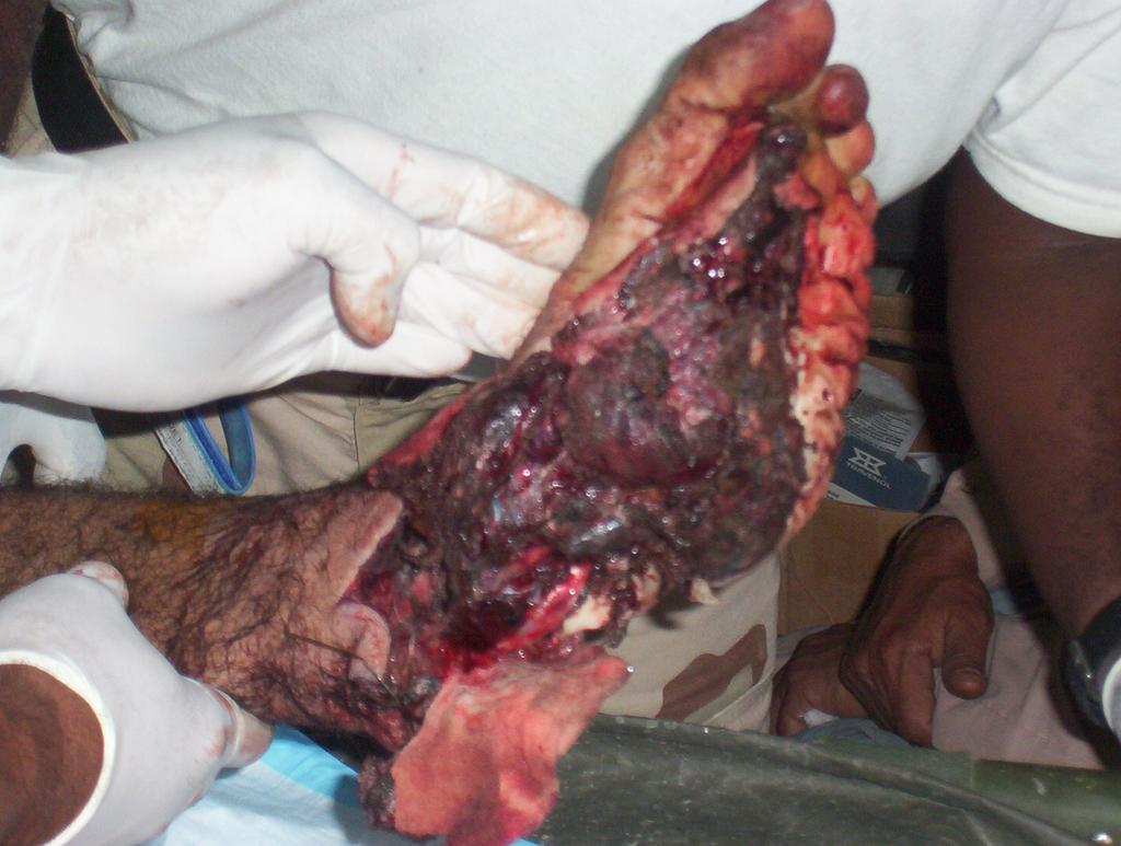 MGoreFamily's tweet photo. Mangsa perang . Amerika babi ludah amerika http://t.co/aNjYW4RN1Z