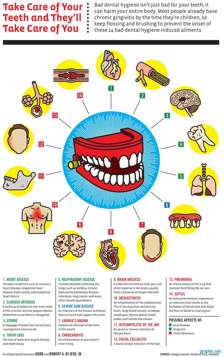 Doc_Howie's tweet photo. Your #teeth affect much more than just your #mouth! http://t.co/rFWF59RRCW