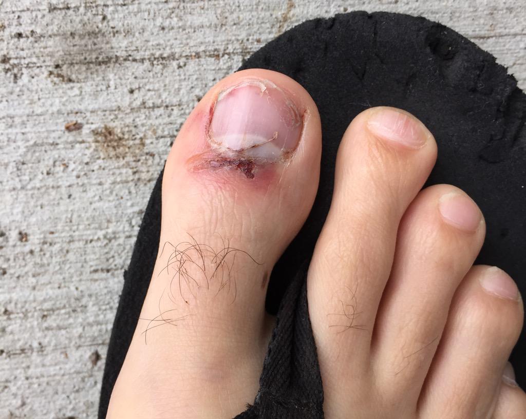 TylerRuinsTV's tweet photo. Ayyyy where my #toesquad at? http://t.co/d5u8bcrIiL