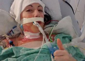 Atteinte de fibrose kystique: la greffe de poumons de Julie Gagnon s'est bien déroulée. bit.ly/1FViKmG