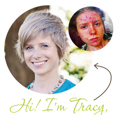 MẬT ONG MANUKA CÓ THỂ ĐIỀU TRỊ CÁC CA BỊ MỤN NẶNG
Tham khảo: thelovevitamin.com/1248/why-is-ma…
lukespharmacy.com.vn