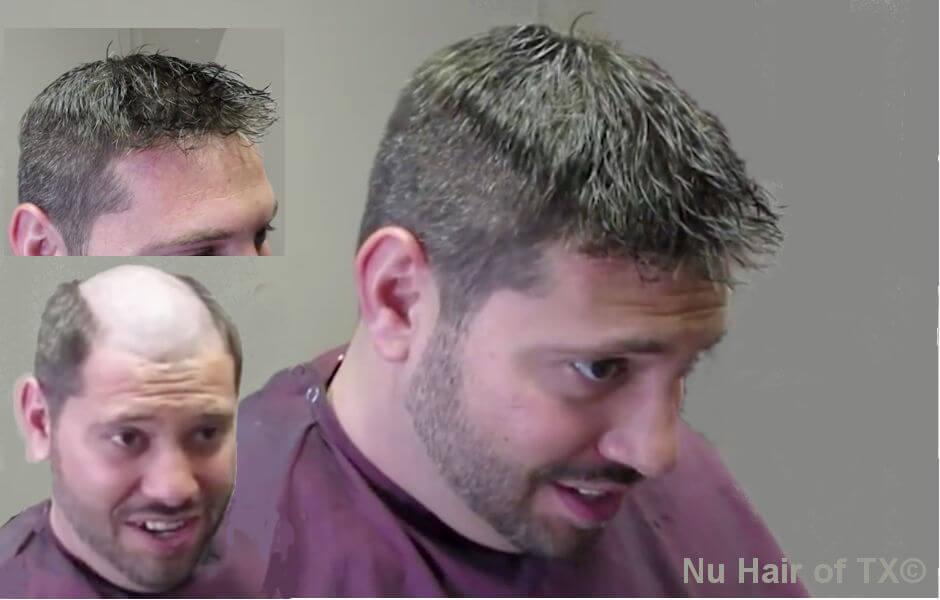 NuHair of Texas (@NuHairTX) / Twitter NuHair of Texas (@NuHairTX) / Twitter