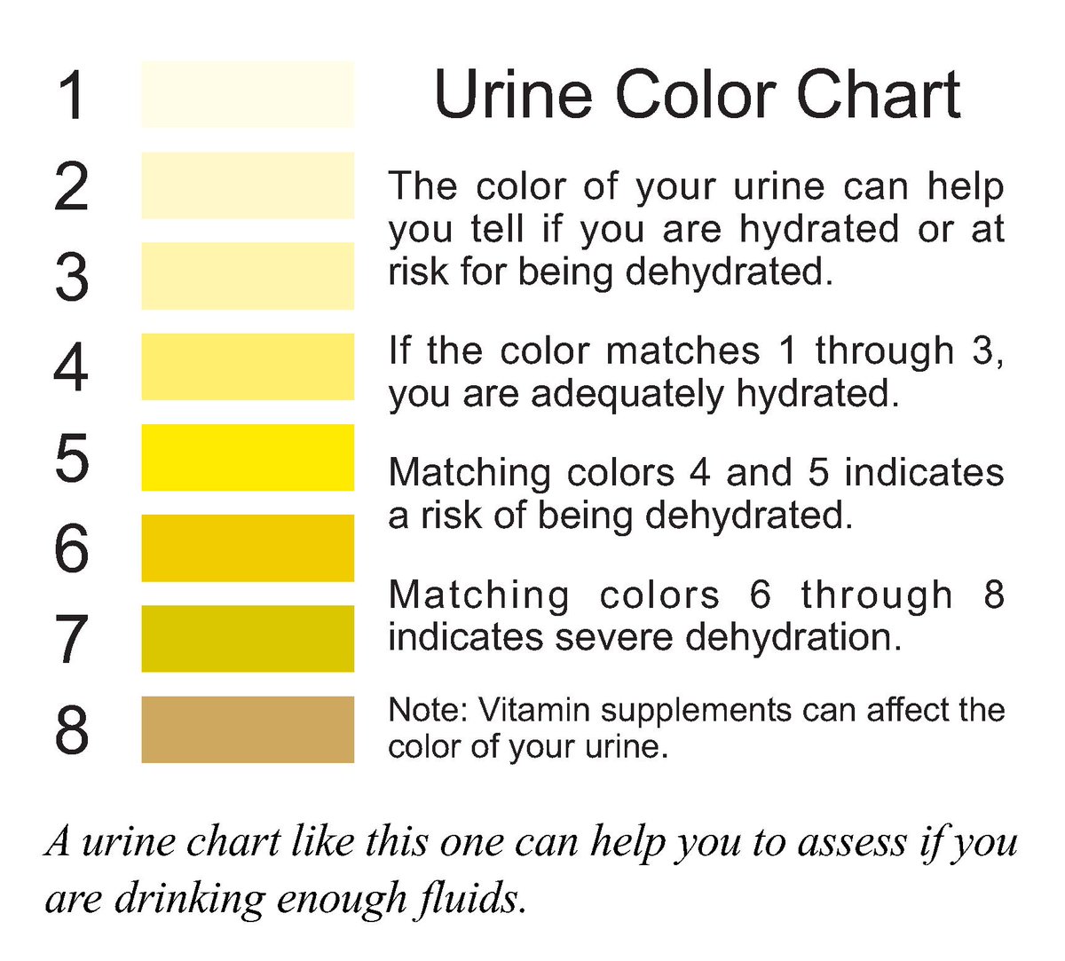 Urine Colour Chart Diabetes