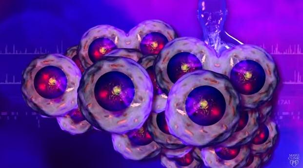 MayoClinic's tweet photo. Beating #AdvancedCancers: New #Epigenomic Block for Advanced Cancer Progression http://t.co/6WT3PW13Dd http://t.co/9aAKOtaaOU