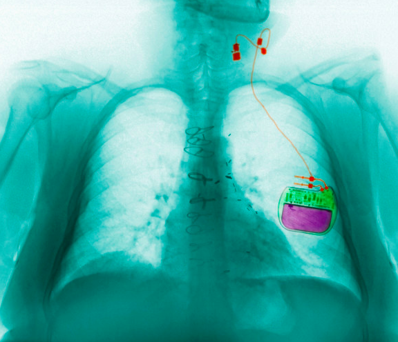 IEEE Engineering Medicine and Biology Society tweet media