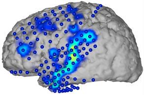 CanovasLechuga's tweet image. #BrainToText system converts speech brainwave patterns to text
#AI #machinelearning 

 kurzweilai.net/brain-to-text-…
