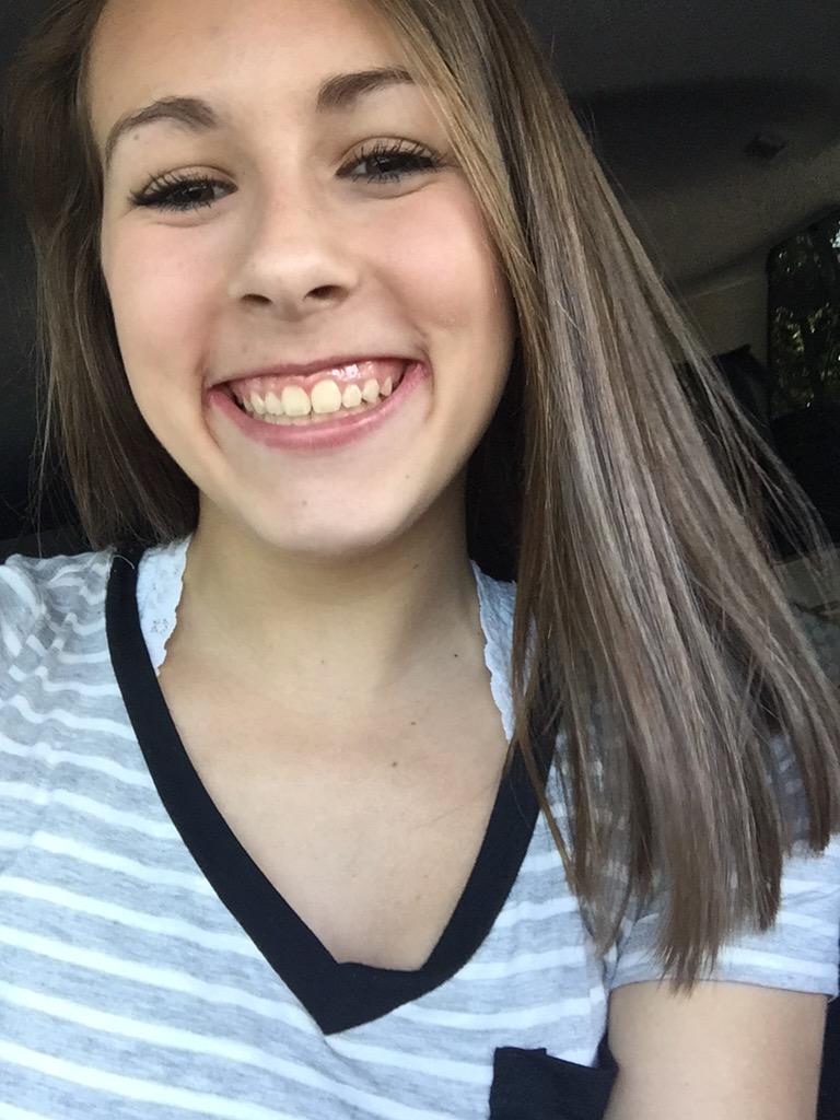 lisablively's tweet photo. Teeth on Fleek ❤️❤️❤️ @faithjames_01 http://t.co/mUp7hyw3Md