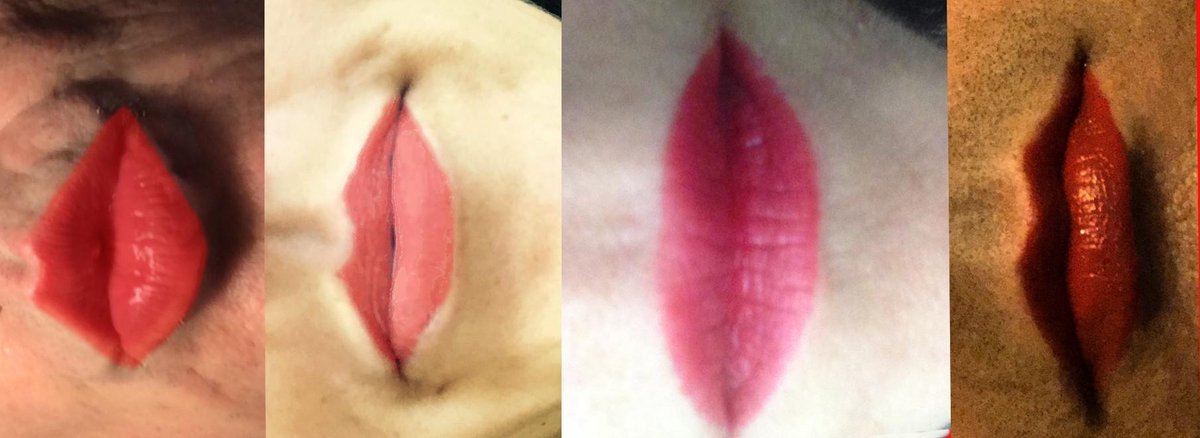ZilicoLtd's tweet image. Here's our #FlipYourLips photo in support of Cervical Screening Awareness Week @RedLippyProject #CSAW. Guess who...