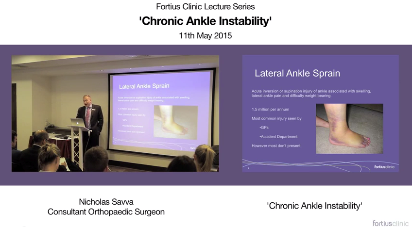 FortiusClinicUK's tweet photo. May videos available here: http://t.co/UN2F6iTNCk. #Hyperlaxity and Joint #Instability in shoulder, foot and hand. http://t.co/lMb78ulmfv