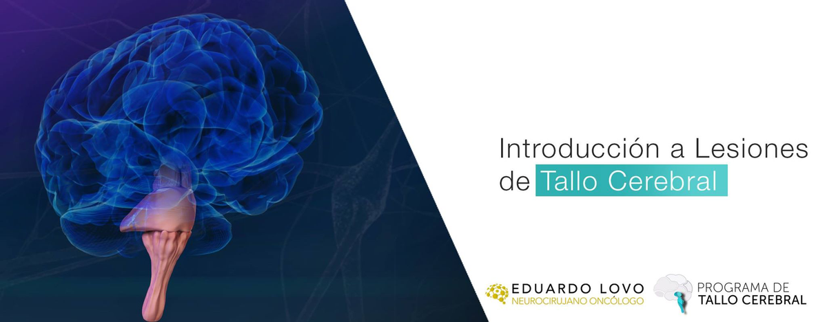 Lesiones de tallo cerebral, de intratables pasaron a ser esperanza de vida para los pacientes goo.gl/TcP94A
