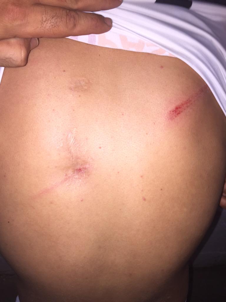 <a href="/extremenoARTE/">ARTE EXTREMEñO</a> ese es el momento que cambio el 4 por el 17 y esas son las secuelas de un QUIEBRAZO de <a href="/DaniPlata2/">Plata</a>