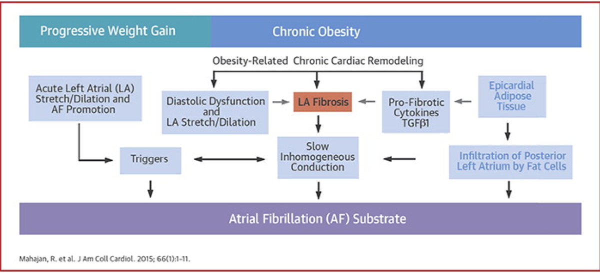drjohnm's tweet photo. Woeful RXs exist for #afib b/c we don’t treat its cause. Look what #obesity does to atria!> 
http://t.co/DJjY7WAmnr http://t.co/XnWvwqlubq