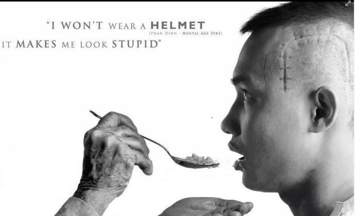 assistedwalker's tweet photo. "Mobility is not overrated"
#braininjury #physicaltherapy #newtechnology

http://t.co/w7FGXCiU01 http://t.co/BeKdHJG0iH