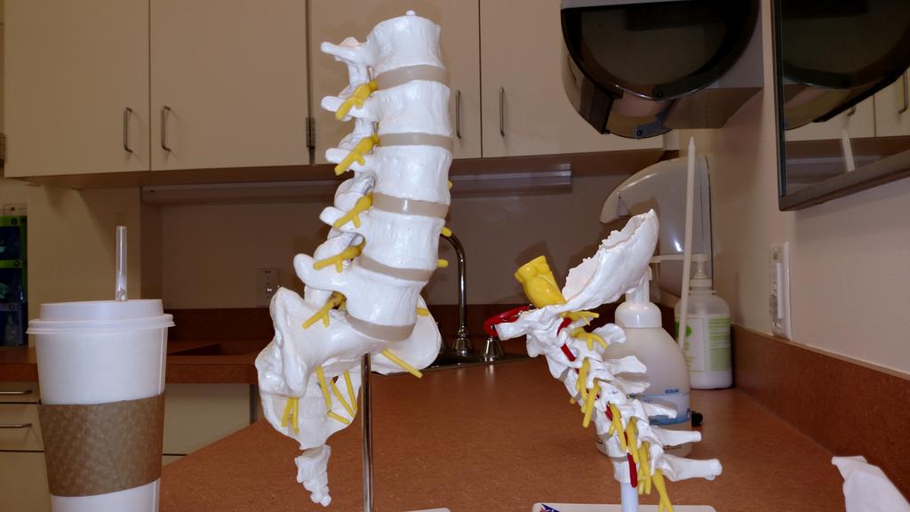 SallyMoore1234's tweet image. SERIOUSLY Who designed this scale? I play with this stuff while I wait! &quot;the disc is like a jelly donut&quot; #BackProblem