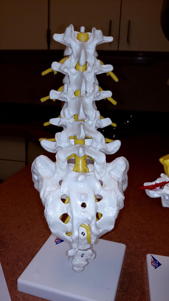 SallyMoore1234's tweet image. SERIOUSLY Who designed this scale? I play with this stuff while I wait! &quot;the disc is like a jelly donut&quot; #BackProblem