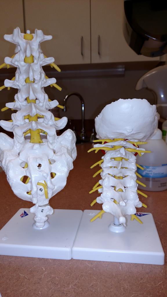 SallyMoore1234's tweet image. SERIOUSLY Who designed this scale? I play with this stuff while I wait! &quot;the disc is like a jelly donut&quot; #BackProblem