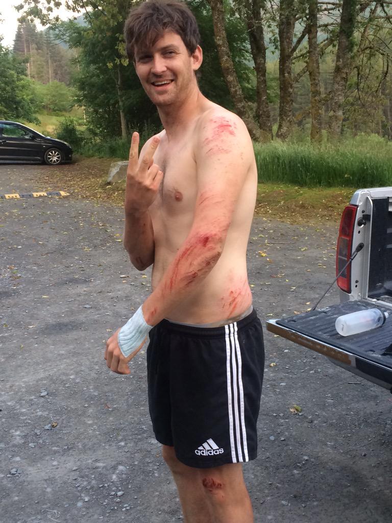 mtbcymru's tweet photo. The wrecking ball that is @Ralphjones88 was back tonight, front tyre rolled after going big! Before/after! #mtb #ouch http://t.co/dqbeOF0koo