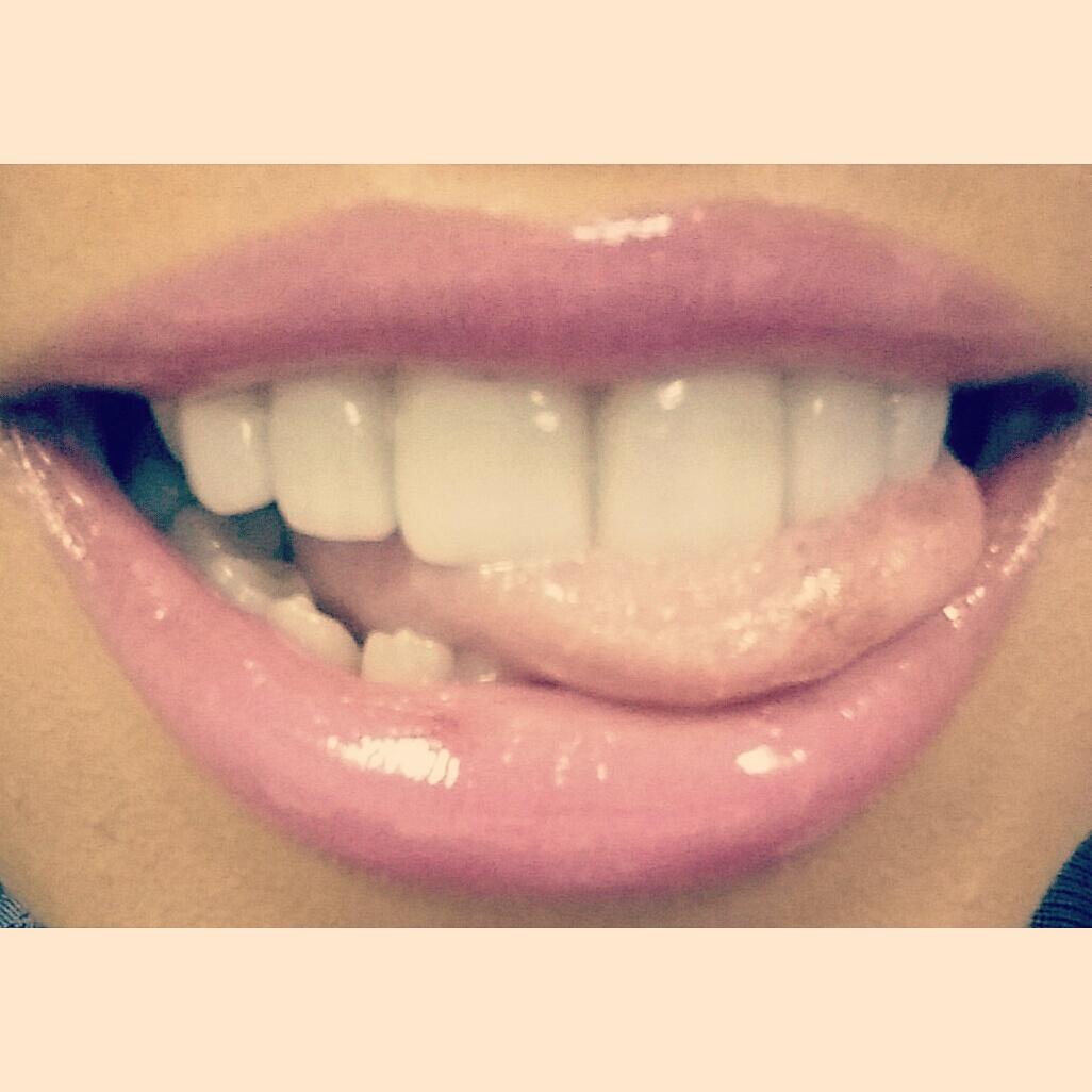 CHEWanWALK's tweet photo. New smile tho 😊 http://t.co/rzxvPK0Ck2
