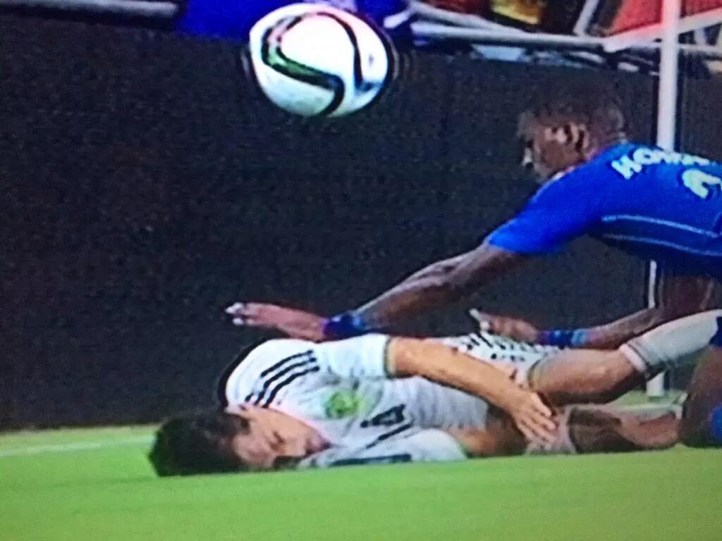 EXAHonduras's tweet photo. Beckeles y su masaje final No feliz
¡Se le zafó la clavícula!
Chicharito estaría fuera de 2 a 3 semanas
#EstaCabal http://t.co/WcualS84Pg