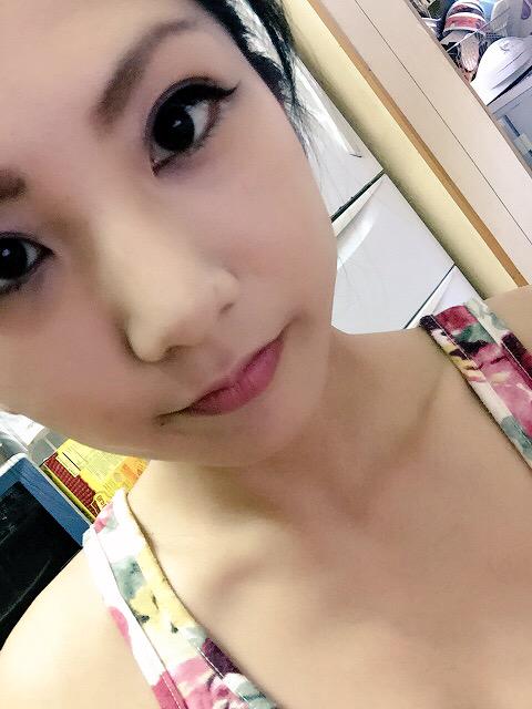 松本 悠愛 On Twitter 親知らず抜いたらめっちゃ頬っぺた腫れとる Http T Co I3w3wo4y54