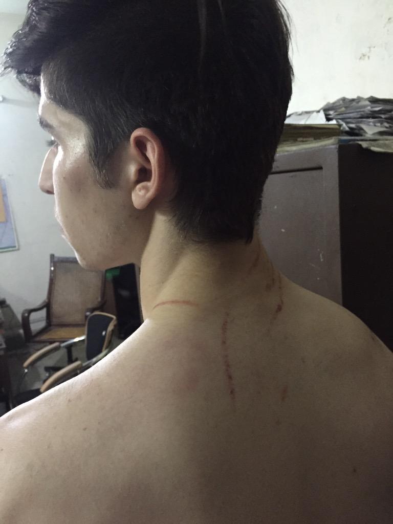 HniaziISF's tweet photo. Breaking:Brutal gulluism. @abdylan12 who faced the worst police torture. http://t.co/AEWMFGo4XJ