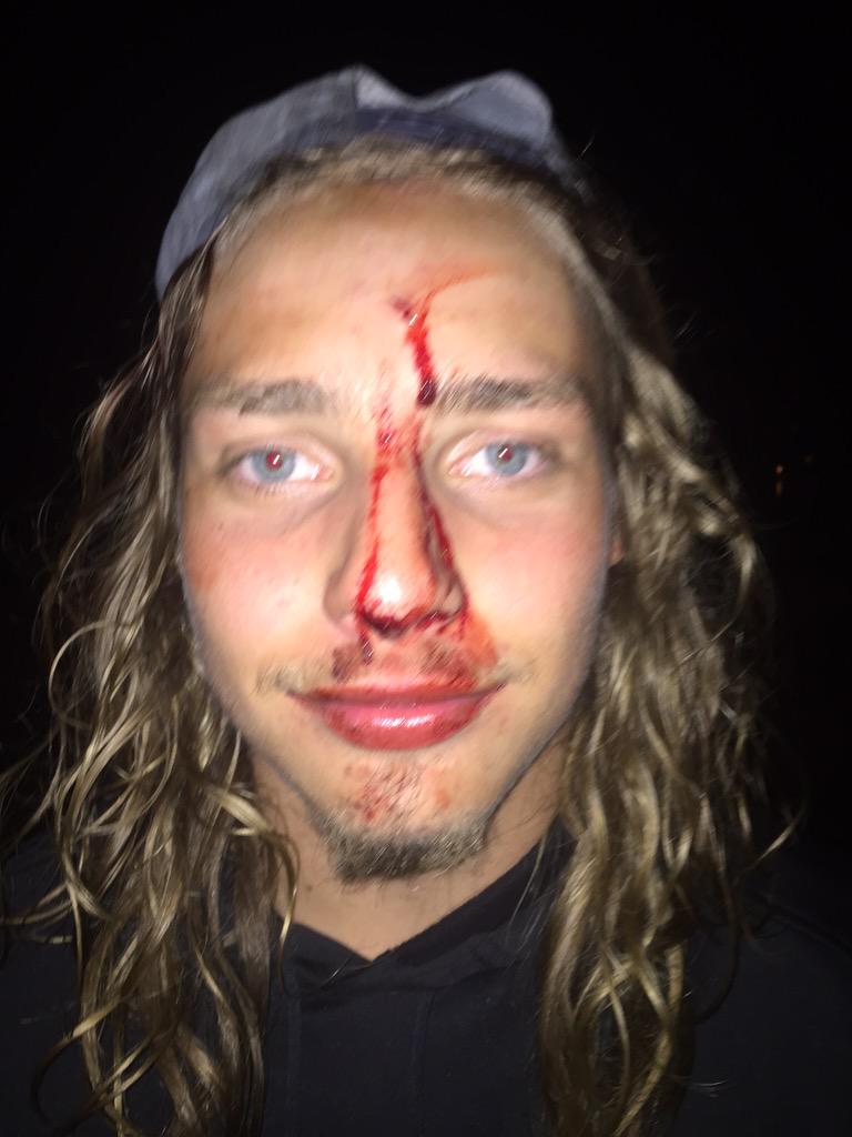 TheParsonianOne's tweet image. Best part of #CanadaDay2015 was watching @devinmuir19 bottle clap himself in shooters #goonsquad