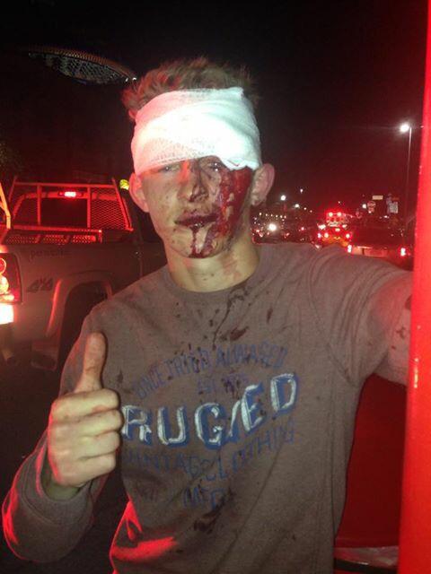 _TyronMartin's tweet photo. Pray for these two beauties🙏🏼 get better boys💙 #prayforscottypandblake @Scottyp_98 @Blake_proko http://t.co/J3U5dsRIVb