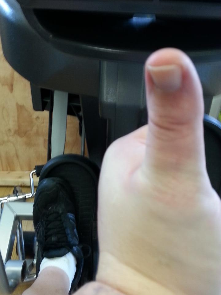 AxlRottenECW's tweet photo. Thumbs up to getting physical therapy done. On the Sci-Fit Machine. #AxlWillWalk http://t.co/7eu5tH1Teo