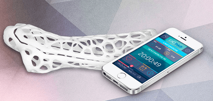 3DPrintGirl's tweet photo. Exovite Aims to Heal Your Broken Bone Faster with 3D Printing http://t.co/TOxeUnP16u http://t.co/HB4vPk99dl