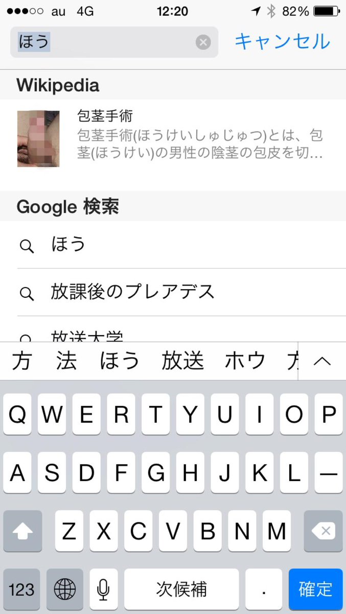 O Xrhsths Dragoner C99金曜東マ12a Sto Twitter 砲撃 とiphoneで ググろうとしたところ ほう と入力した段階でサジェスト機能でwikipediaの 包茎手術 の包茎写真がモザイク無しでいきなり表示された 画像は自分で モザ処理した マジでこんな機能止めろよ