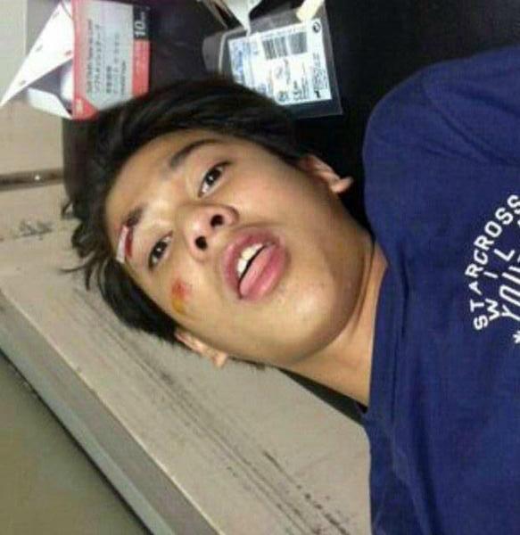 FAzzanyati's tweet photo. gws baal, kami selalu do'a utk lo kok, lo banyak istirahat yakk @iqbaale http://t.co/2vPiFLDGxJ