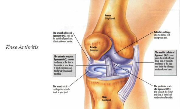 kneejointcare's tweet photo. Knee Arthroplasty is a surgical procedure used to relieve arthritis.
#KneeJointReplacement
http://t.co/Koqi8agowq http://t.co/5YBxLhckLC