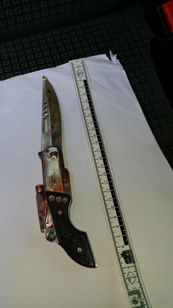 Miracle of 20yr Old Israeli Policeman - Stabbed Neck &amp; Chest in Jerusalem Yesterday - Praying bit.ly/1GBVJI2