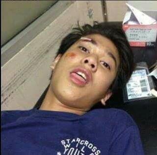 SaryPayung's tweet photo. Liat deh kondisi wajah Iqbaal. Yanglain pada cemasin lah dia fotonya kayak gitu:'v http://t.co/FemwQY1P9x