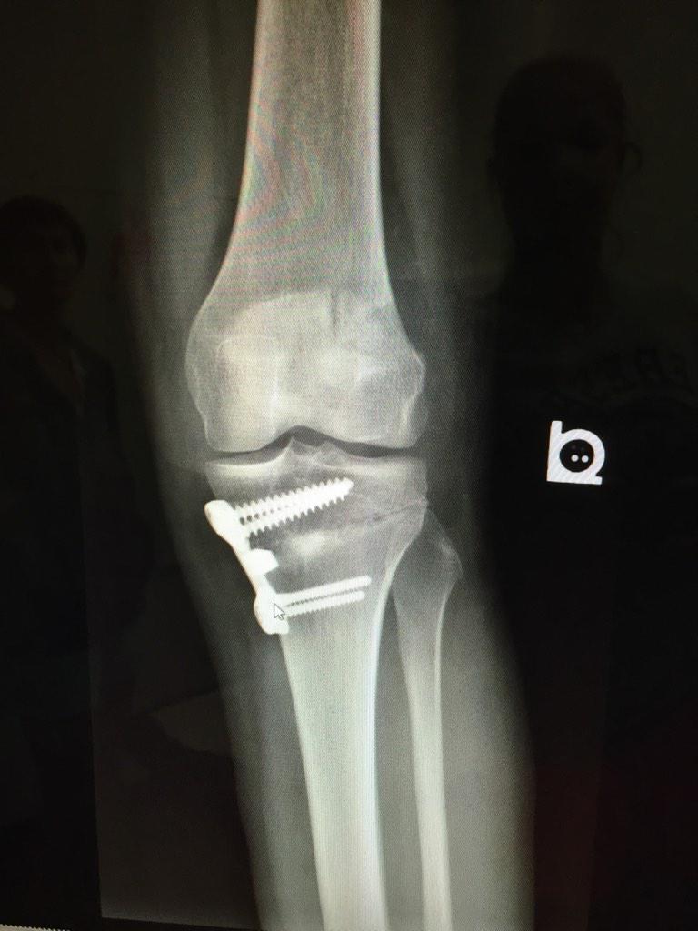 Kay_Hal's tweet image. Can't wait for airport security, take care out there. #BionicWoman