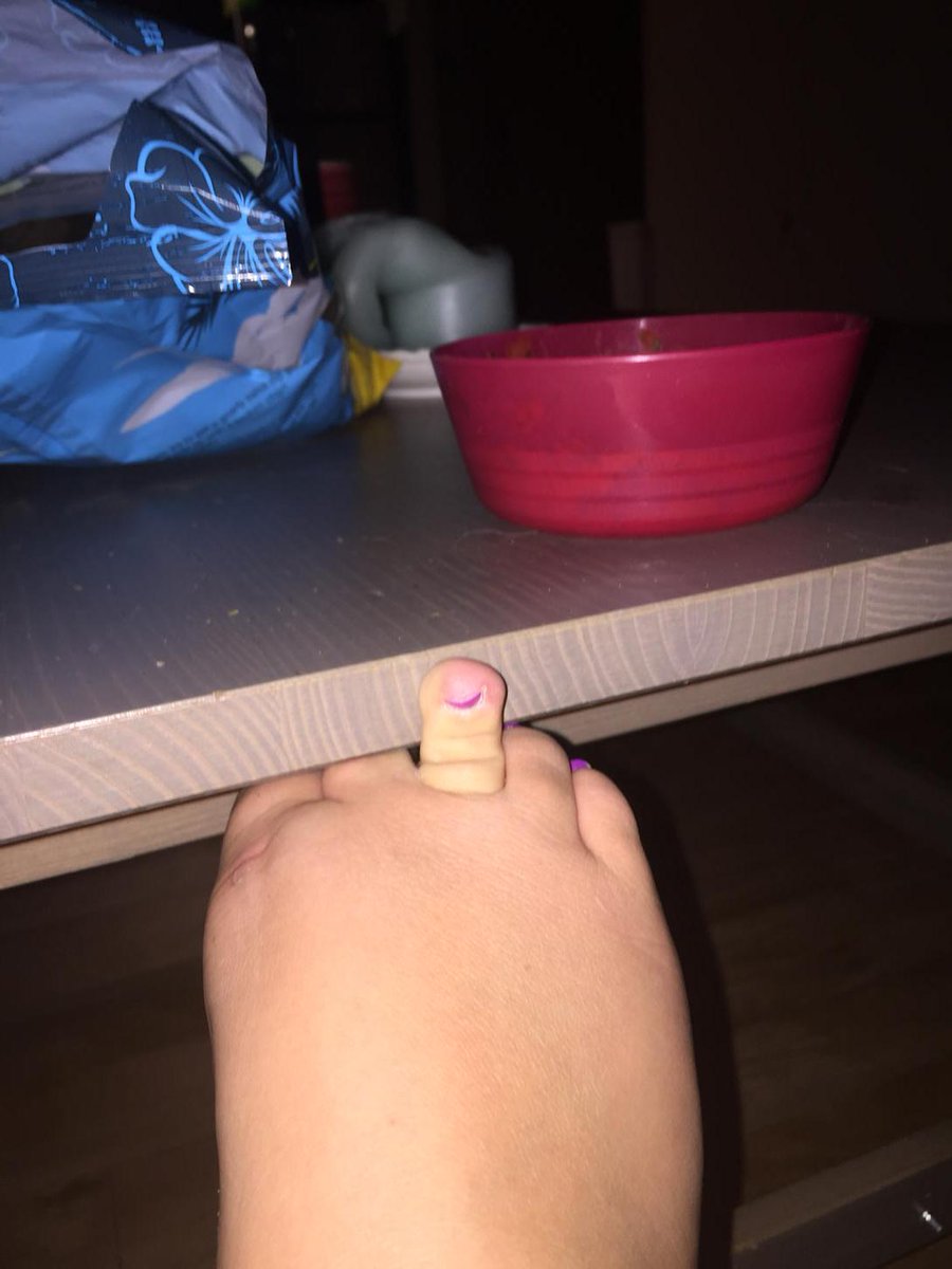 lillygately23's tweet photo. "If you're ever mad at someone just send them this picture" #alliestoeissocute #middletoe http://t.co/Bd8fsya3YP