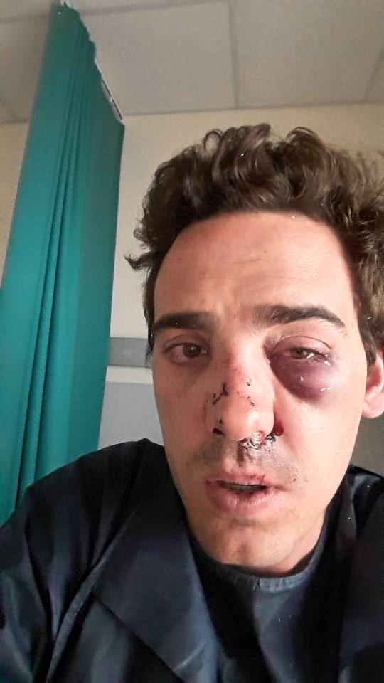 __Cxmille_'s tweet photo. Ce client d’UberPop a été agressé hier soir à Lyon par des chauffeurs de taxi… un max de RT pour le soutenir http://t.co/e8eYMR5wWJ
