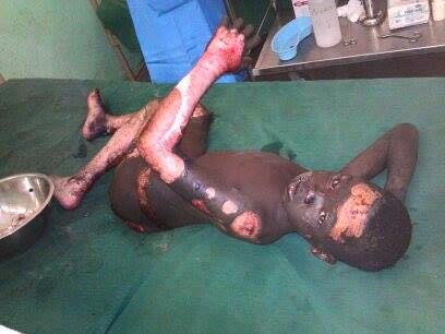 solchi055's tweet photo. @JakeBerry #Buhari and #Nigeria rains death on #Biafra villages again with Napalm bombs #Genocide2015 in #Biafra" http://t.co/nSBFMOYBFq