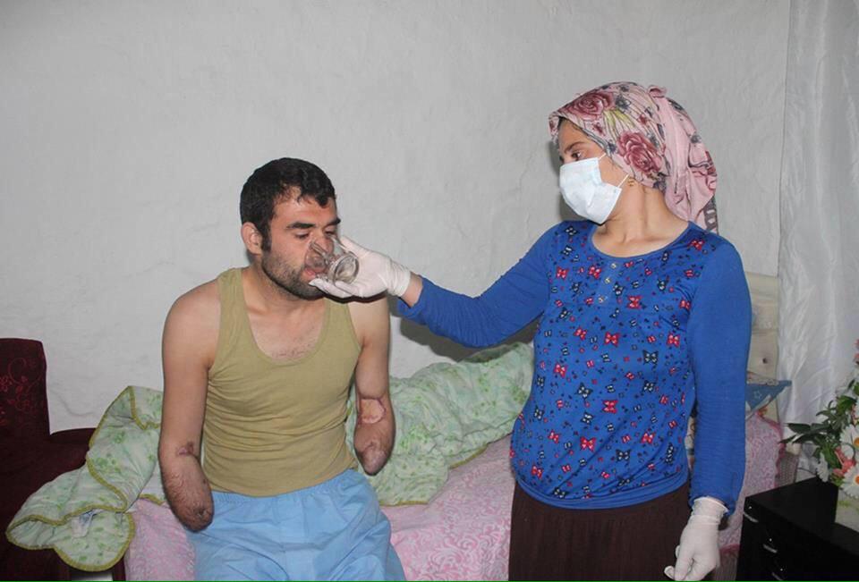 Mardin Kızıltepe'de yaşayan 5 Çocuk babası Yılmaz Şimşek'in protez ellere ihtiyacı varmış
<a href="/Sehri_Mardin/">tarihi kent Mardin</a>