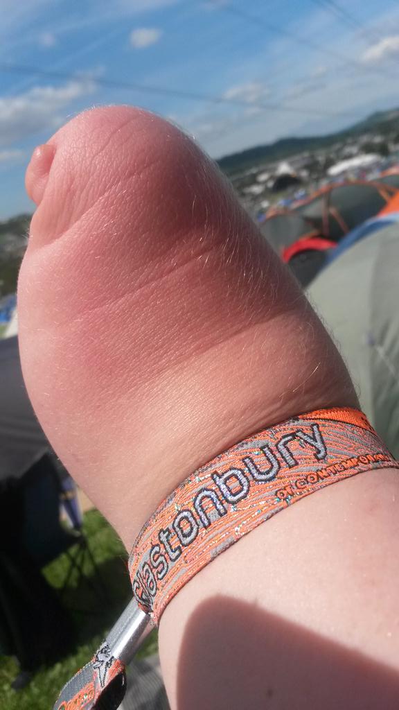 nickyashwell's tweet image. Feeling a little lost without my #bebionic this week but my arm does have a new accessory #Glasto2015