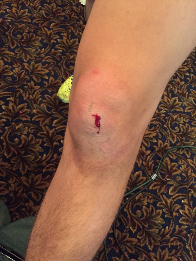 SummerExcitemnt's tweet photo. A successful Quick Start at #SE15IAM = 1 knee injury. #theworm #RedWon http://t.co/KScf8CEmyH