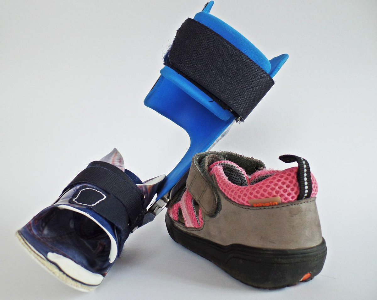 SpibiFoundation's tweet photo. Wist je dat... Spibi Foundation een 2de paar orthopedische schoenen kan aanbieden aan kinderen met Spina Bifida? http://t.co/FJ5Ebes0Ro